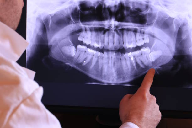 Best Emergency Dental Care for Broken or Chipped Teeth in Jasper, AL