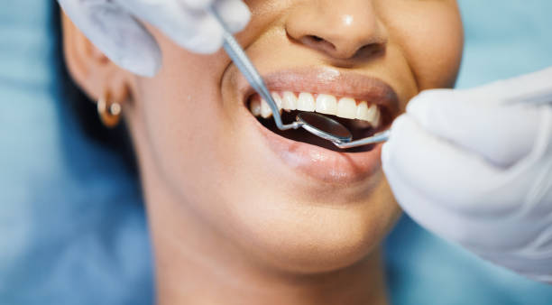 Best Emergency Treatment for Dental Infections or Abscesses in Jasper, AL